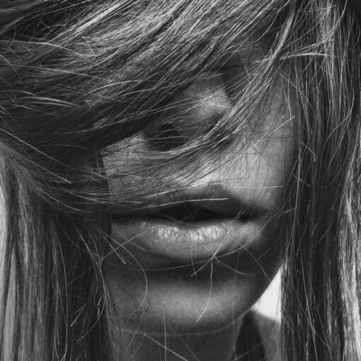 Will Hair Testing Nail Your Patient’s Nickel Problem?
